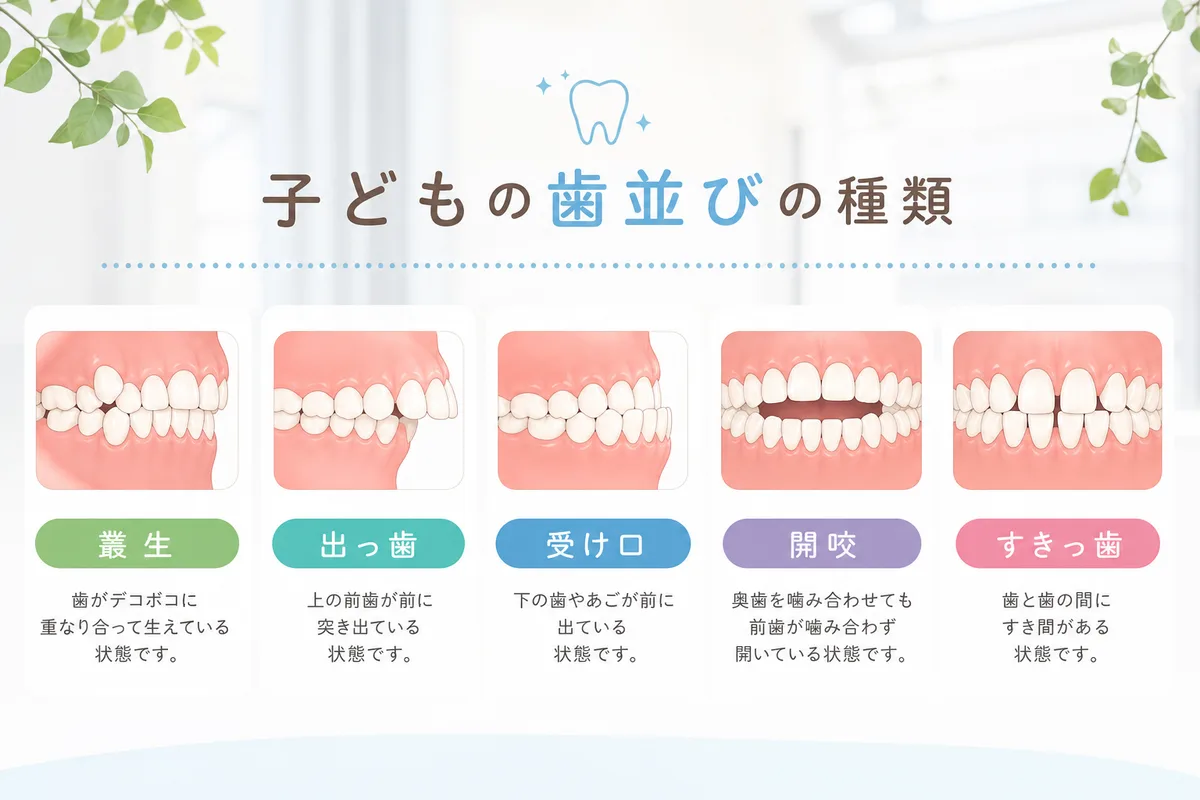 子どもの歯並びの種類と原因は?整うと起きる5つのこと